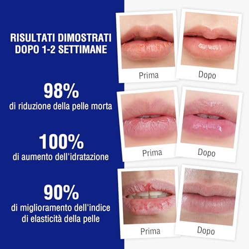 Medicated Lip Balm w/Beeswax, Petrolatum, Peppermint Oi, 100% Natural Ingredients, 24H Long-lasting Hydrating Healing Lip Balms, Lip Moisturizer for Very Dry Lips, Echapped Lips Treatment Severe