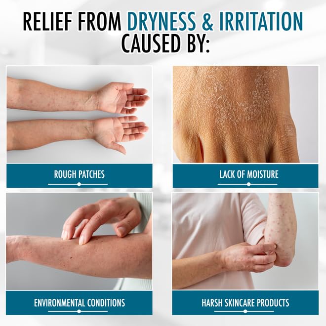 GLY MIRACLE Lightly Scented Non-Greasy Body Lotion, 16 oz High-Glycerin Hydration for Extremely Dry Skin, Hands, Feet & Body