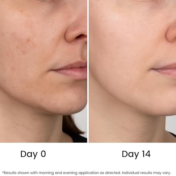 All Natural Pure 20% Vitamin C Serum Face + 6 Active Boosters for Dark Spots, Wrinkles, Brightening, Hydrating, Even Tone, Healthy Glow with Niacinamide, Hyaluronic Acid, Ferulic Acid, Vitamin E
