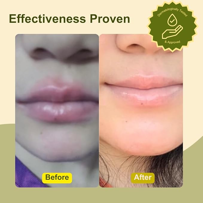 Ginger Lip Balm – Natural Lip Brightening Balm for Pigmented, Dull or Dark Lips – Fragrance-Free, Essential Oil-Free Hydrating Lip Treatment for Sensitive Skin, Eczema-Prone Lips, Adults & Kids (0.17 oz)