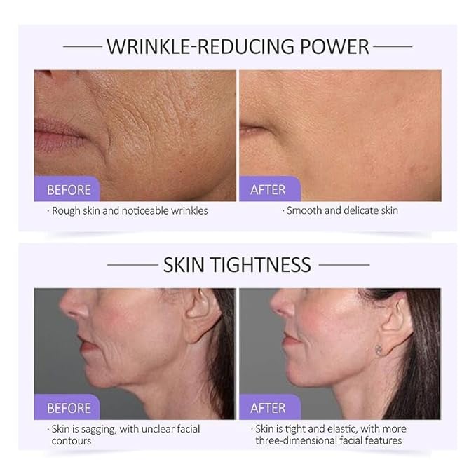 Collagen Serum For Face, Collagen Face Serum For Skin Tightening Helps Lift, Plump, & Firm Sagging Skin, Serums For Skin Care, Anti Wrinkle 1.35 Fl Oz
