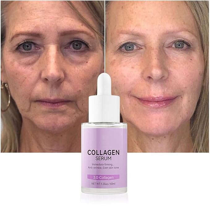 Collagen Serum For Face, Collagen Face Serum For Skin Tightening Helps Lift, Plump, & Firm Sagging Skin, Serums For Skin Care, Anti Wrinkle 1.35 Fl Oz