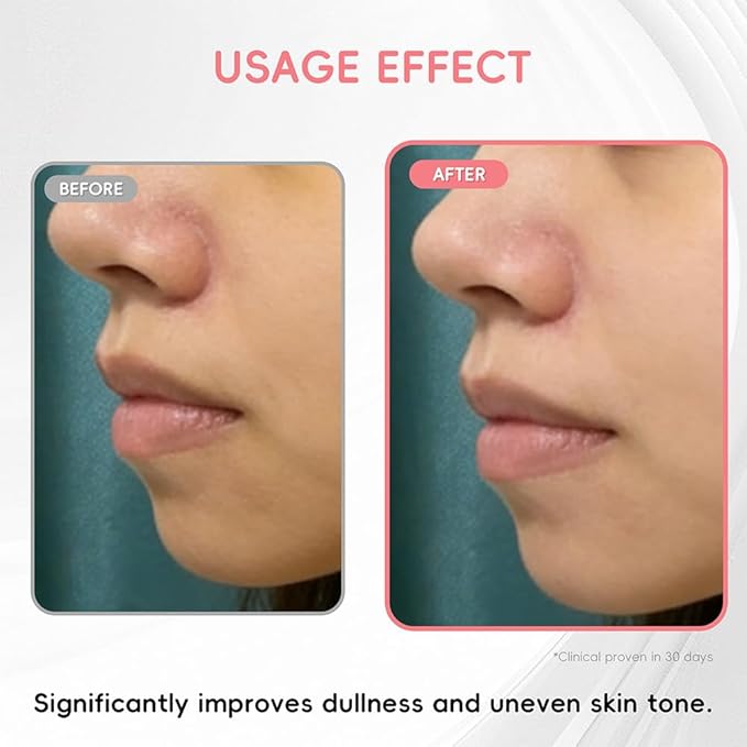 Brightening Glowing Serum-Niacinamide Tranexamic acid,brightening,even skin tone,anti-oxidant