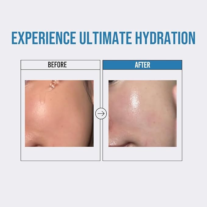 Jumiso Waterfull Hyaluronic Acid Serum 1.69 fl.oz / 50ml | Face Moisturizer, Facial Hydrating Serum for All Skin Types, Moisture Booster for Dry Skin | Vegan, Fragrance-Free
