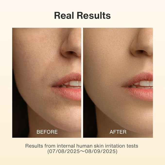 Capsule Serum with New Packaging,BEAUTY SERUM WITH VITAMIN C, V Serum, 1.0 fl oz (30 ml), Vitamin C Derivative, Concentrate, Rough, Dullness, Dry