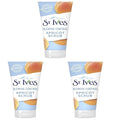 St Ives Gentle Apricot Facial Scrub 150Ml (Pack of 3)