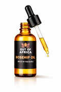 Rosehip Oil for Face – Lightweight, Fast-Absorbing, 100% Pure Cold-Pressed Facial Oil for Daily Use (1 fl oz)