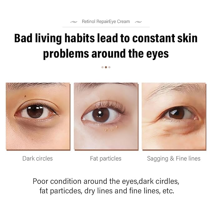 2 Pcs Retinol Repair Eye Cream，Instant Results Eye Cream，Reduces the Appearance of Dark Circles，Stretch Wrinkles at the Corners of the Eyes，Moisturize and Improve Eye Bags，1.05 Oz Each