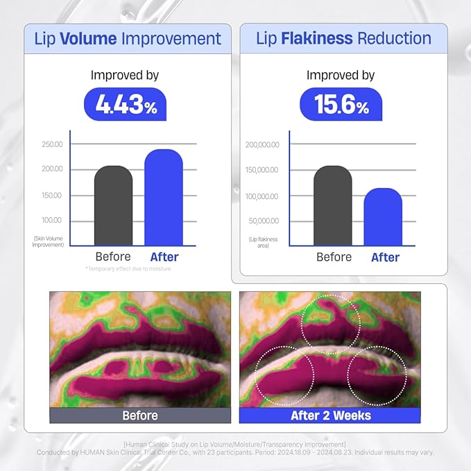 DERMATORY Hyalluron Peptide Volume Lip Mask Balm - Hydrating & Moisturizing Lip Mask for Day & Night Care (10ml)