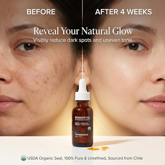 Offernova Organic Rosa de Mosqueta Oil- USDA Certified Rosehip Seed Oil Pure Cold Pressed, Repairs & Brightens Skin - Gua Sha Massage, Face, for All Skin Types - Aceite Facial 1OZ