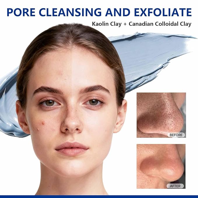 Deep Pore Cleansing Blue Clay Mask for Face, Zero Pore Blackhead Mud Facial Mask with Niacinamide for Even Out, Hydrating Mud Mask with Brush for All Skin Types, 5.3 oz Large Size