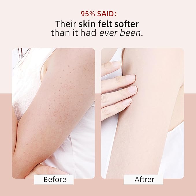 KP Bump Eraser Body Scrub with 10% AHA BHA Ingrown Hair Keratosis Pilaris Razor Bump Treatment Exfoliating Body Scrub Exfoliant Face Scrubs for Strawberry Leg Pre-shaven Blackhead 4.23OZ
