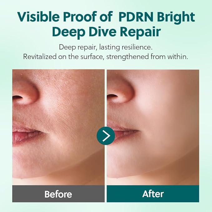 PDRN + Panthenol Reverse Aging Deep Dive Serum, 30% Vegan PDRN, Firming & Radiance Boost, Barrier Support & Hydrating Formula, Fragrance-Free, 30ml (1.01 fl oz)