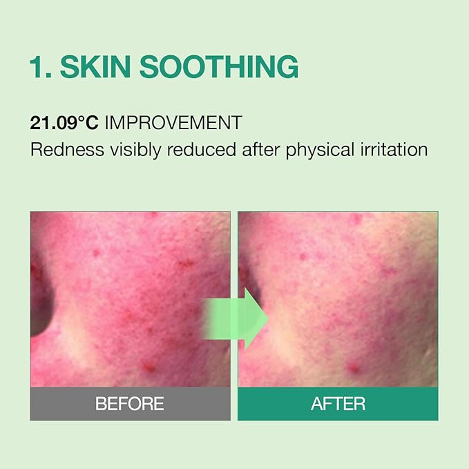 Tea Tree Soothing In Calming Cream for Sensitive Skin with Tea Tree Oil & Cica, Helps reduce redness and breakouts, Soothing skin and providing hydration, Korean Skin Care (2.70 fl.oz)