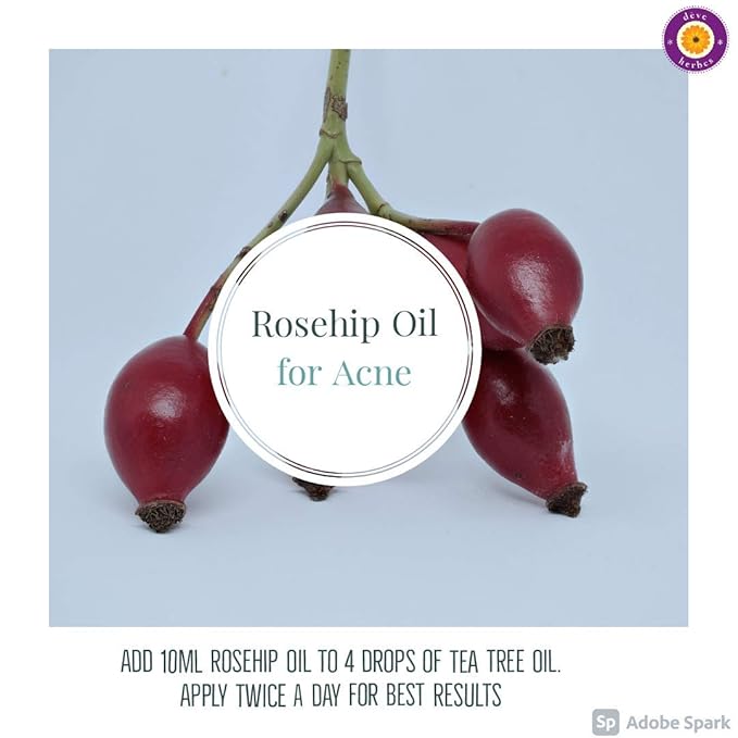 dève herbes Pure Rosehip Oil (Rosa rubiginosa) with Glass Dropper Cold Pressed 100ml (3.38 oz)