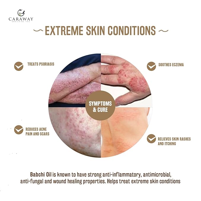 CARAWAY BAKUCHI OIL - Supercritical CO2 Extract| Pure Babchi Oil for Skin, Pigmentation, Vitiligo & Uneven skin tone| Bakuchi Seed Oil – 50ml