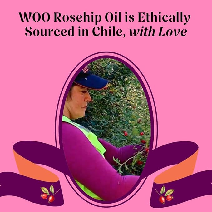 Certified Organic Rosehip Oil – 100% Pure, Cold-Pressed & Fair Trade | Face & Body Oil | Vitamin A, C & E Rich | Boosts Collagen, Fades Scars & Dark Spots, Soothes Acne | 3.4 oz