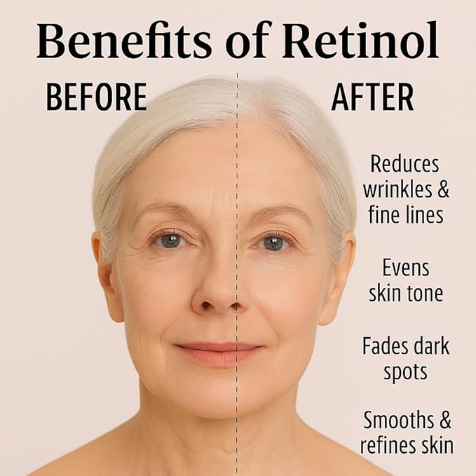 Retinol 1% Anti-Aging Face Serum for Wrinkles, Fine Lines & Dark Spots, Improves Skin Texture, Night Treatment | High Cosmetic Agency,Skincare Formula