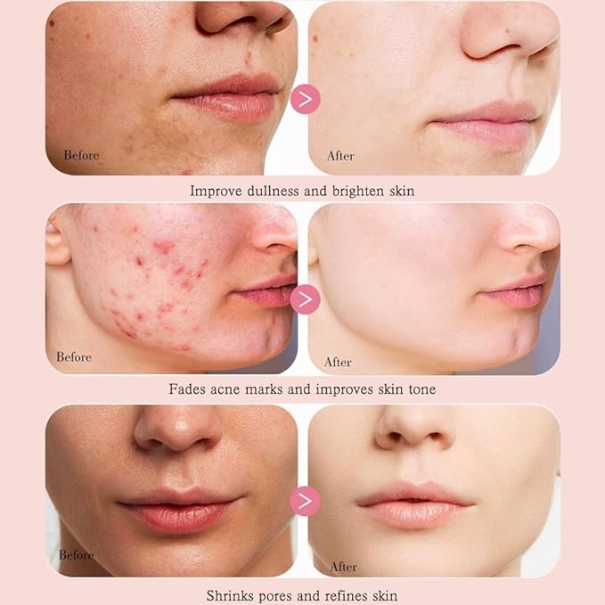Peach 70 Niacinamide Serum, Dark Spot Correcting Serum for Face Hydrating, Facial Serum for Oily Skin, Daily Clean