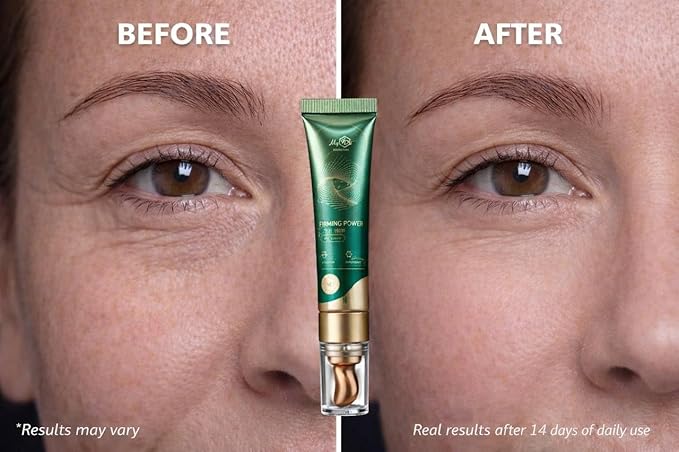 Hydrating Dark Circle Eye Cream - Firming Power Under Eye Serum - Caffeine & Vitamin C & E - Anti Aging & Repairing - Vegan & Cruelty-Free, 15 ml