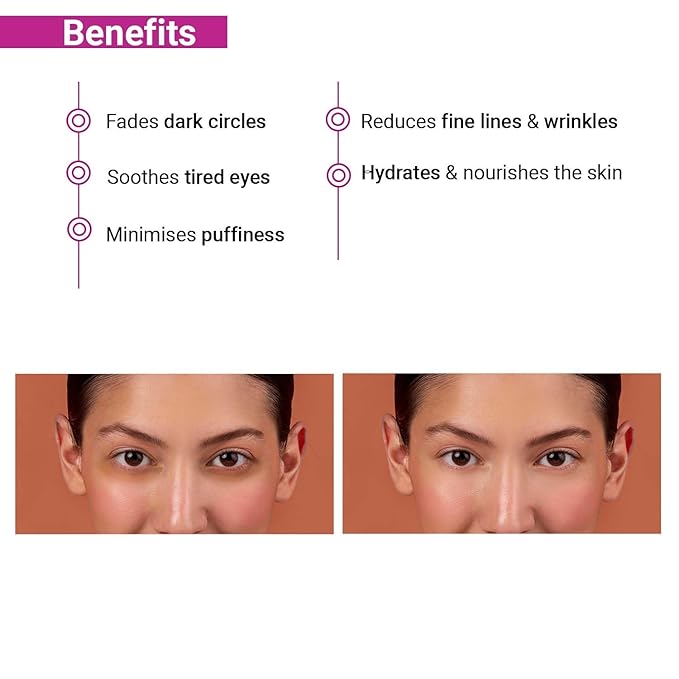 SOTRUE I-Luminate Under Eye Cream For Dark Circles For Women | For Puffy Eyes & Fine Lines, 15G | Enriched With Aloe Vera, Jojoba Seed & Vitamin E | Suitable For All Skin Types