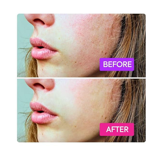 IYKYK by Makari Probiotics Booster Serum | Skin Barrier Support Hydration Serum with Vitamin F, Omega 3 & 6 & Squalane | Vegan, Fragrance-Free, Dermatologist Tested