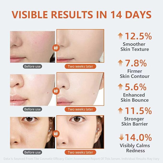 Multi-Action Serum with Hyaluronic Acid, Centella & Peptides, For Radiant Glow, Barrier Support, Hydration & Soothing, Lactobacillus Postbiotic Daily Facial Booster for All Skin Types, 1 Fl Oz