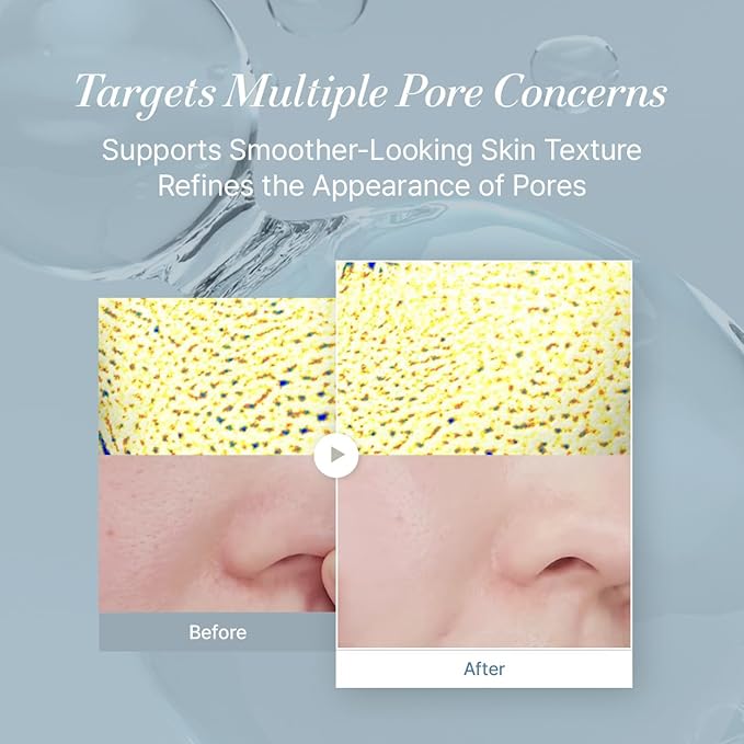 starlike Niacinamide 21% Pore Serum I 1.69 Fl oz (50ml) I Korean Moisturizing & Oil Balancing Facial Serum I Soothing, Lightweight & Fresh Finish I 17 Amino Acids & Hyaluronic I Glowing Skin Care