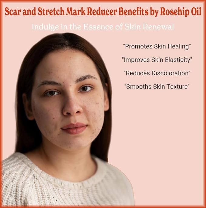 Natural Born Oils Rosehip Seed Oil, 16oz, Organic, Cold-Pressed, Nutrient-Rich, Excellent for Radiant Skin, Lustrous Hair
