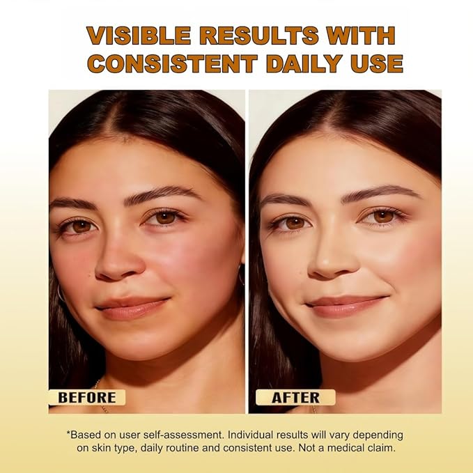 Salmon DNA PDRN Honey Nourishing Serum 30ml, Hydrating Soothing Face Serum with Panthenol, Korean Skin Care for Sensitive Blemish-Prone Skin, Calms The Look of Redness