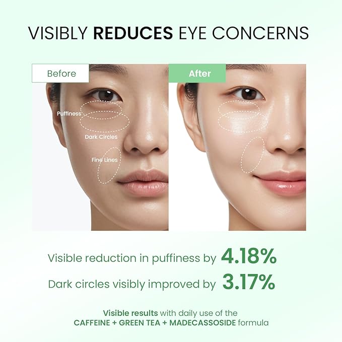 Dongyu Eye Cream Anti Aging: Caffeine Green Tea Eye Cream for Beauty Enthusiasts - Puffy Eye Treatment Morning Night Use (Green)