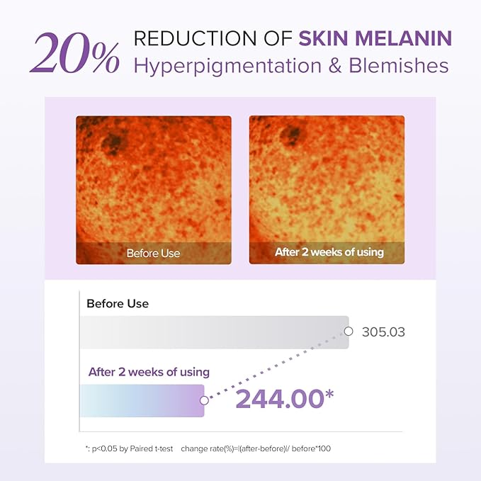 Mary&May Tranexamic Acid + Glutathione Eye Cream (30ml) - Korean Skincare for Dark Circles & Uneven tone - Fragrance-Free Under Eye Cream for Dark Spots & Hyperpigmentation 1.01oz.