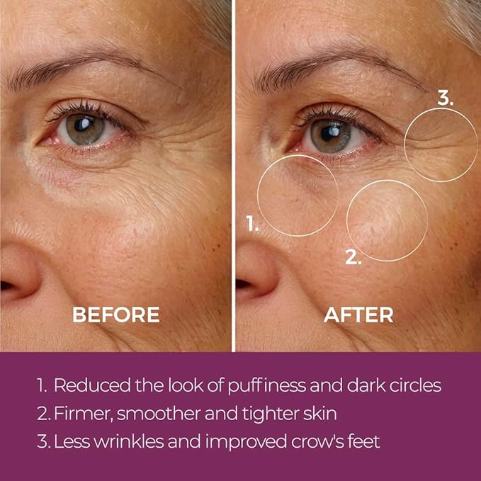 blinc Eye Repair Peptide Complex | Clean, Vegan, Eye Cream | Anti-Aging, Anti-Wrinkle, Ultra Hydrating | Reduces Fine Lines, Dark Circles & Puffiness | Brightens, Firms & Evens Skin | 15 g / 0.53 oz