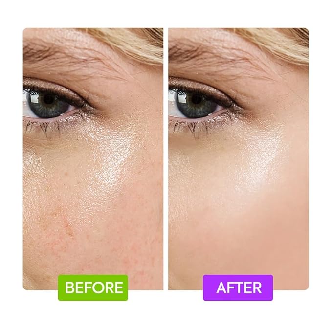 IYKYK by Makari 20% AHA + 10% Niacinamide Booster Serum 2 Pack | Gentle Body Exfoliation with Glycolic & Lactic Acid to Smooth Skin | Enhance Appearance, and Reveal Radiant Softness