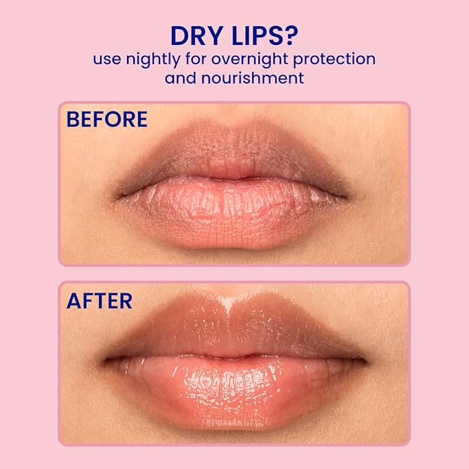 FaceTory Berry Jam Lip Sleeping Mask with Strawberry Fruit Extract and Shea Butter - for Softer Lips, for Dry, Cracked, and Chapped Lips, Moisturizing, Protecting, Nourishing - 10g