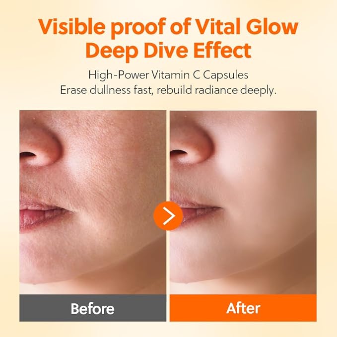 Vitamin C + Ceramide Glow Deep Dive Serum, Antioxidant Brightening Booster for Dark Spots, Skin Barrier Support, Fragrance-Free, 30ml (1.01 fl oz)