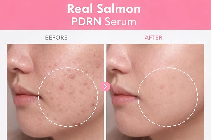 PDRN Peptide Repair Serum – High-Purity Salmon DNA, Peptide Complex, Niacinamide – Hydrating & Firming Facial Serum – Made in Korea