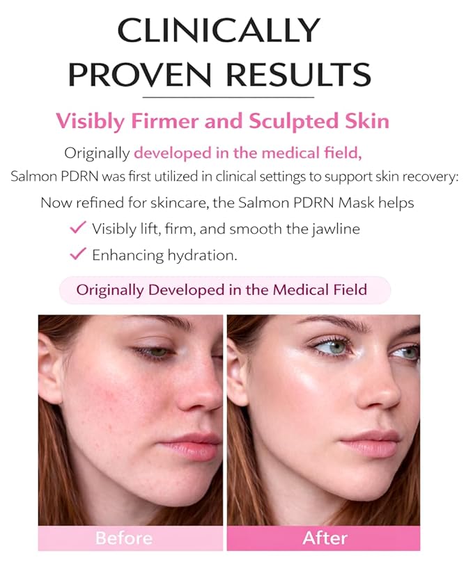 5 Pack Salmon DNA Collagen Mask 99% PDRN Anti-Aging Gel Mask | Overnight Firming & Hydrating Face Mask for Elasticity & Glow | Korean Skincare with Niacinamide, Peptides & Hydrolyzed Collagen