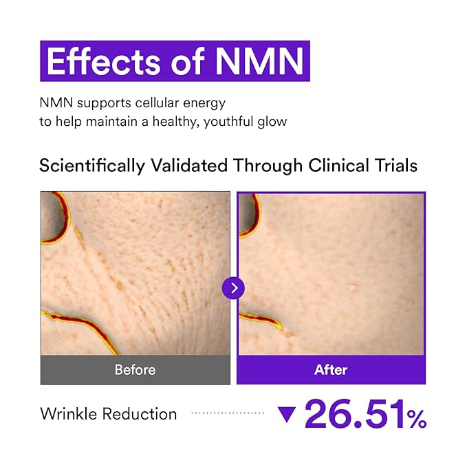 VEGANIFECT NMN Collagen Serum | Elasticity & Firm-Looking Booster with Peptides & Centella Asiatica & Hyaluronic Acid | Skin Resilience & Fine Line Care | Korean Skincare, 1.01 fl.oz
