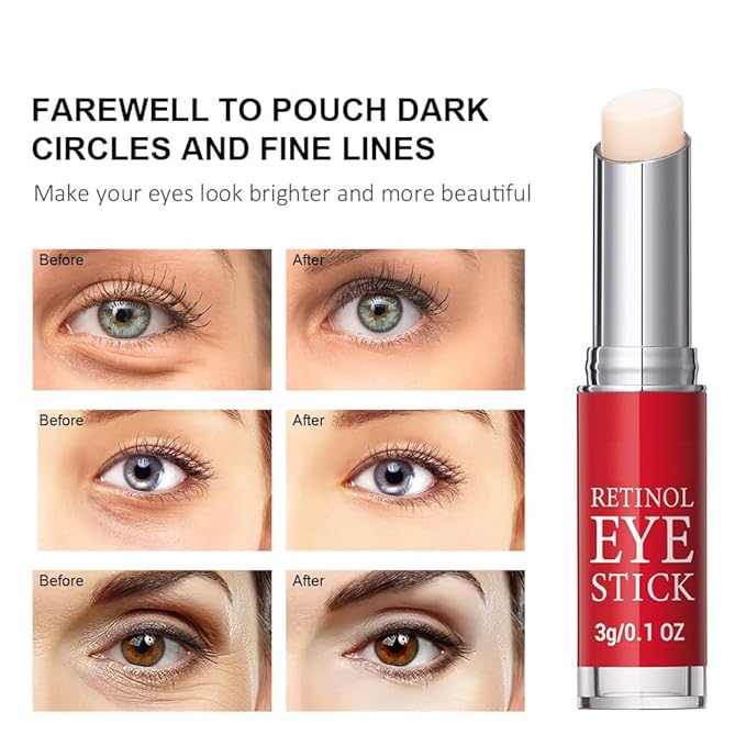 Retinol Eye Stick, Retinol Eye Cream With Collagen,Hyaluronic Acid For Dark Circle, Wrinkles, Under EyeCream Anti Aging, Reduces Puffiness Fine Lines, Visible Results in 3-4 Weeks