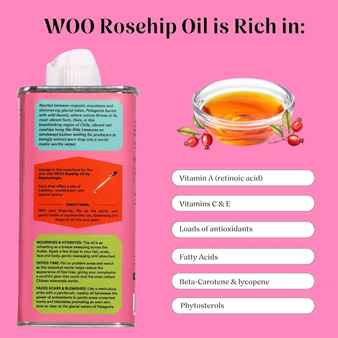 Certified Organic Rosehip Oil – 100% Pure, Cold-Pressed & Fair Trade | Face & Body Oil | Vitamin A, C & E Rich | Boosts Collagen, Fades Scars & Dark Spots, Soothes Acne | 3.4 oz
