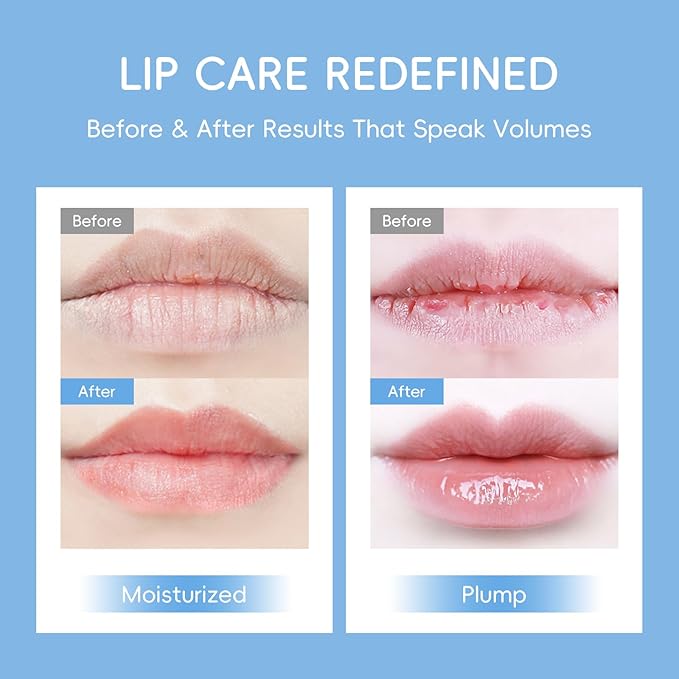 AKARY Milk Hydrating Lip Mask Gels with Hyaluronic Acid, Shea Butter & Vitamin E – Ultra Moisturizing, Soften Cuticle, Keep Plump Lip Patches for Dry Lips, Hydration & Repair, Day & Night Use (10)