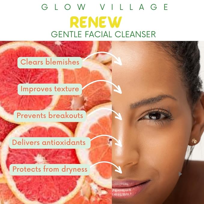 Renew Gentle Facial Cleanser with Botanical Hyaluronic Acid | Vegan, Organic | Deep Cleansing, Blemish-Fighting | For Sensitive and Combination Skin| Fragrance Free | 4 oz