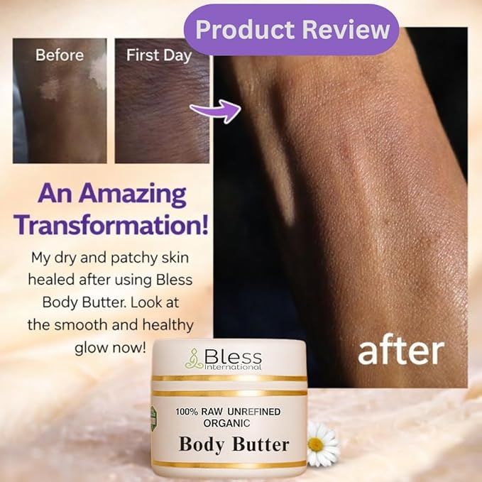 Organic Raw Vanilla Butter 100% Pure,Natural & Unrefined| Skin Moisturizer For Face, Body & Hair| 4 OZ/115 GM Ivory / White Grade A | DIY Creams, Balms, Lotions, Soaps| Softens Dry & Tough Skin