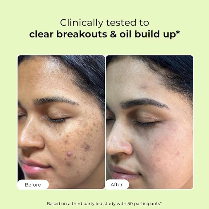 Conscious Chemist® 2% Salicylic Acid Face Wash | 100ml | Face Wash for Oily & Acne Prone Skin for Men & Women, Glycolic Acid & CICA Extract, For Glowing & Radiant Skin, Vegan & Cruelty Free - Flashfix