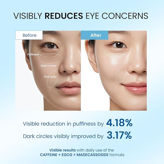Dongyu Eye Cream for Dark Circles: Korean Caffeine Eye Cream Daily Morning Skincare - Puffy Eyes Treatment for Beauty Enthusiasts (Blue)