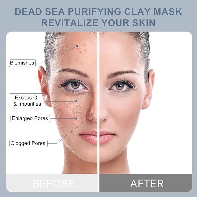 TJE Dead Sea Mud Mask, Deep Cleansing Facial Clay Mask for Acne, Blackheads, Minimize Pores, Moisturizing, Purifying Clay Masks for Dull & Tired Skin