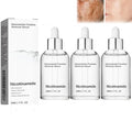 Generic Niacinamide Freckles Removal Serum, Sunnylas Niacinamide Freckles Removal Serum, Niacinamide Serum for Face and Body, Nicotinamide Serum for Blemishes, for All Type Skin (3PCS)