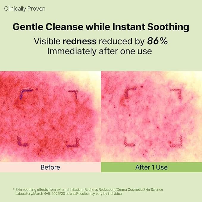 DearMYDEW HYCICA Soothing Gentle Cleansing Foam | Low pH 5.5 Cleanser for Sensitive Skin, Calming Hydrating Cica Face Wash & Barrier Care, Centella, Ultra-Low Molecular HA, Korean Skincare, 5.07 fl oz