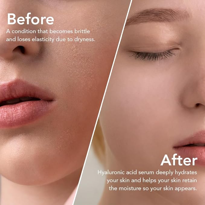 Olivia & Allison Hyaluronic Acid Serum 1.0 fl oz - With Panthenol + Olive Leaf Extract for Hydration & Calming Care